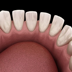 a digital illustration of gapped teeth