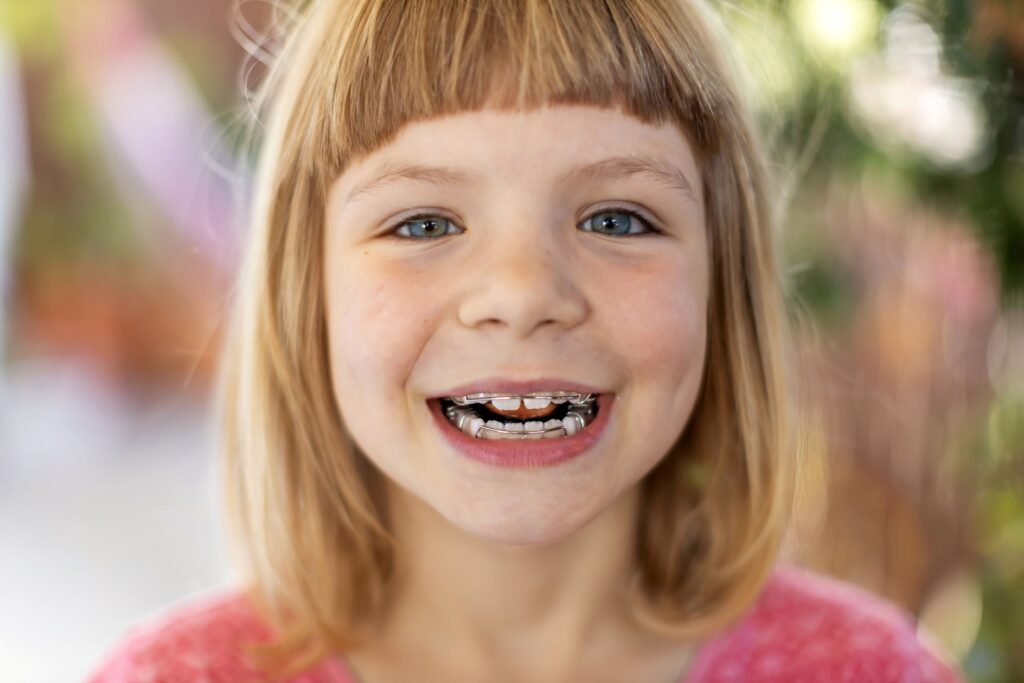 Little girl with blue eyes smiling with oral appliance over teeth